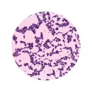 Gram, Lugol, Azul de lactofenol